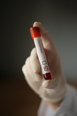 Press release: ITIC warns on the importance of checking crew COVID-19 tests