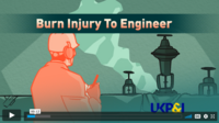 Lessons Learnt: Burn Injury to Engineer